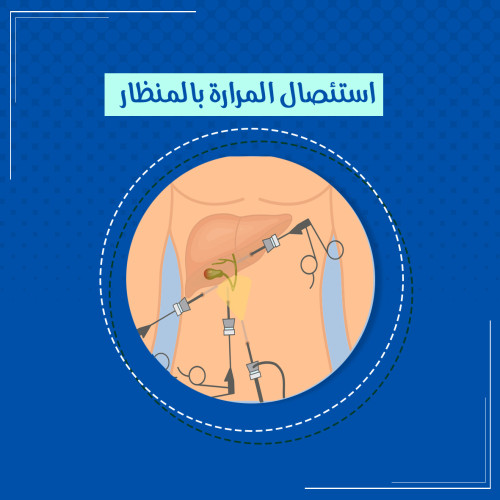 Article1